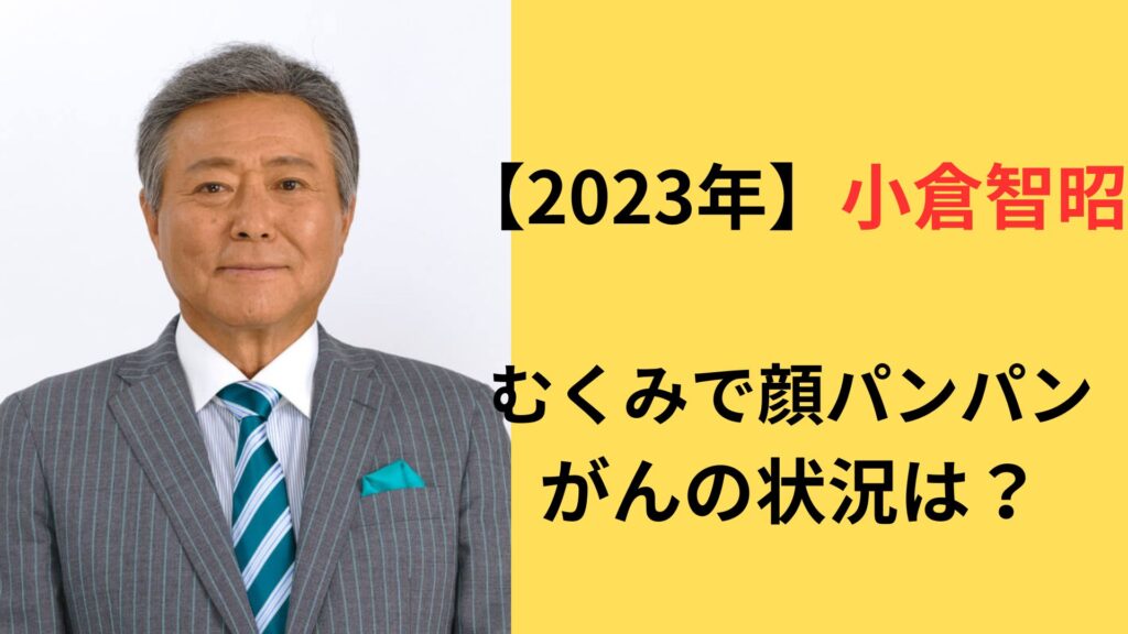 【2023年】小倉智昭の現在がむくみで顔パンパン！がんの状況がどうなっているのかも調査